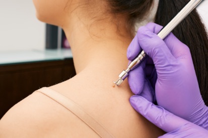 Skin Rejuvenation And Aesthetics